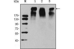 Western blot analysis using KI67 mouse mAb against Hela (1), MCF-7 (2) and Raji (3) cell lysate. (Ki-67 抗体)