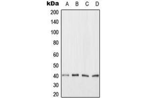 Western blot analysis of ANKRD1 expression in HeLa (A), Jurkat (B), NIH3T3 (C), H9C2 (D) whole cell lysates. (ANKRD1 抗体  (C-Term))