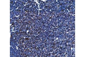 IHC analysis of TFEB using anti-TFEB antibody (ABIN7599321).