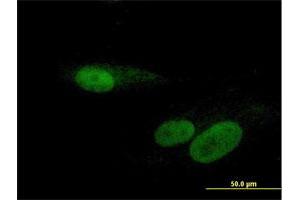 Immunofluorescence (IF) image for anti-RNA Binding Motif Protein, Y-Linked, Family 1, Member F (RBMY1F) (AA 1-496) antibody (ABIN949881)