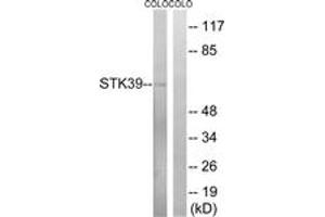 Western blot analysis of extracts from COLO cells, using STK39 (Ab-325) Antibody. (STK39 抗体  (AA 291-340))