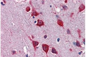 Human Brain, Cortex (formalin-fixed, paraffin-embedded) stained with TBX5 antibody ABIN462189 followed by biotinylated goat anti-rabbit IgG secondary antibody ABIN481713, alkaline phosphatase-streptavidin and chromogen. (T-Box 5 抗体  (AA 174-223))