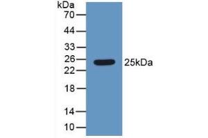 Detection of Recombinant HMG1, Human using Polyclonal Antibody to High Mobility Group Protein 1 (HMGB1) (HMGB1 抗体  (AA 1-215))