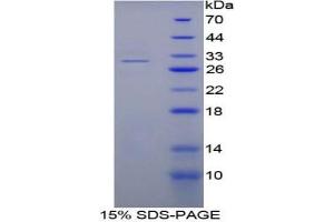 SDS-PAGE analysis of Mouse Fibrinogen alpha Protein. (FGA 蛋白)