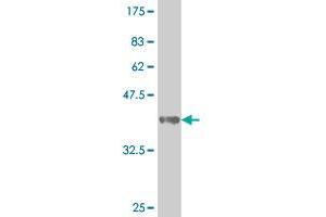 Western Blot detection against Immunogen (39. (SMAD3 抗体  (AA 147-270))