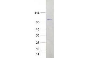 Western Blotting (WB) image for Leucine Rich Repeat Containing 40 (LRRC40) protein (Myc-DYKDDDDK Tag) (ABIN2724916)