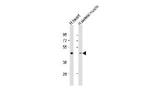 All lanes : Anti- at 1:1000 dilution Lane 1: human heart lysate Lane 2: human skeletal muscle lysate Lysates/proteins at 20 μg per lane. (PDK2 抗体)