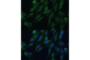 Immunofluorescence analysis of C6 cells using DRG2 antibody (ABIN7266746) at dilution of 1:100. (DRG2 抗体  (AA 150-260))