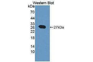 Detection of Recombinant PFKP, Rat using Polyclonal Antibody to Phosphofructokinase, Platelet (PFKP) (PFKP 抗体  (AA 354-570))