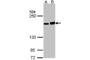 WB Image Sample (30 ug of whole cell lysate) A: H1299 B: Raji 5% SDS PAGE antibody diluted at 1:1000 (DIAPH1 抗体  (C-Term))