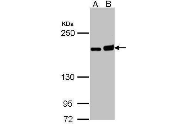 DIAPH1 抗体  (C-Term)
