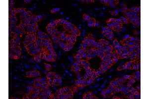 Immunofluorescence (IF) image for anti-Receptor tyrosine-protein kinase erbB-2 (ErbB2/Her2) (C-Term) antibody (ABIN7448962)