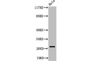 Western Blot analysis of HeLa cells using Cleaved-Integrin α6 LC (E942) Polyclonal Antibody (ITGA6 抗体  (Cleaved-Glu942))