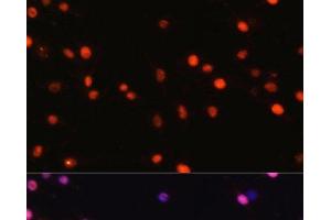 Immunofluorescence (IF) image for anti-DNA (Cytosine-5)-Methyltransferase 1 (DNMT1) antibody (ABIN7259344)