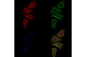 ABIN6261932 and ABIN6277595 staining Hela cells by IF/ICC.