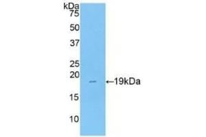 Western Blotting (WB) image for anti-Collagen, Type VIII, alpha 1 (COL8A1) (AA 590-744) antibody (ABIN7437539)