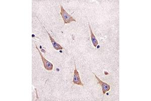 Paraformaldehyde-fixed, paraffin embedded human brain tissue, Antigen retrieval by boiling in sodium citrate buffer (pH6. (RAB11A 抗体)