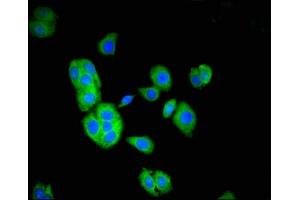 Immunofluorescent analysis of HepG2 cells using ABIN7171513 at dilution of 1:100 and Alexa Fluor 488-congugated AffiniPure Goat Anti-Rabbit IgG(H+L) (TOM1 抗体  (AA 306-487))