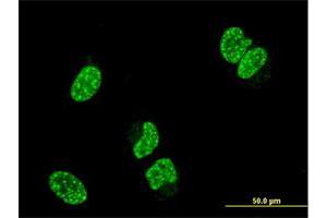 Immunofluorescence (IF) image for anti-TP53 Regulating Kinase (TP53RK) (AA 154-253) antibody (ABIN566698)