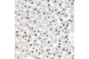 Immunohistochemistry of paraffin-embedded rat liver using U2SURP antibody (ABIN6132839, ABIN6149759, ABIN6149760 and ABIN6220240) at dilution of 1:100 (40x lens). (SR140 抗体  (AA 705-1029))