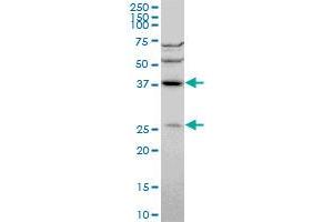 Western Blotting (WB) image for anti-DnaJ (Hsp40) Homolog, Subfamily B, Member 6 (DNAJB6) (AA 1-241) antibody (ABIN564339)