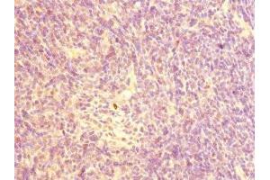 Immunohistochemistry of paraffin-embedded human thymus tissue using ABIN7161343 at dilution of 1:100 (CHRNA1 抗体  (AA 25-240))