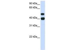 Image no. 1 for anti-Ubiquitin Specific Peptidase 22 (USP22) (AA 72-121) antibody (ABIN6741442) (USP22 抗体  (AA 72-121))