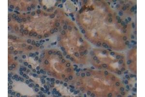 Immunohistochemistry (IHC) image for anti-Cathepsin A (CTSA) (AA 215-470) antibody (ABIN7438739)