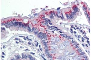 Colon, Human: Formalin-Fixed, Paraffin-Embedded (FFPE) (PDIA3 抗体)