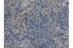 Immunohistochemistry (IHC) image for anti-Protein tyrosine Phosphatase, Receptor Type, A (PTPRA) (AA 618-796) antibody (ABIN5014195)