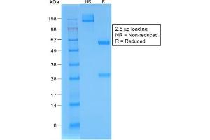 SDS-PAGE Analysis Purified BrdU Rabbit Recombinant Monoclonal Antibody (BRD/1539R). (Recombinant BrdU 抗体)