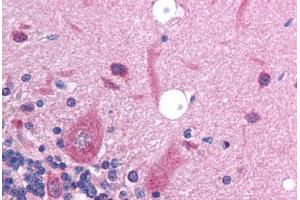 Image no. 1 for anti-Solute Carrier Family 17 (Anion/Sugar Transporter), Member 2 (SLC17A2) (AA 230-279) antibody (ABIN6736429)