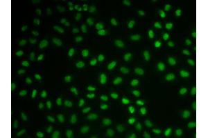 Immunofluorescence (IF) image for anti-Cardiac Troponin C (TNNC1) (AA 1-160) antibody (ABIN3015719) (TNNC1 抗体  (AA 1-160))