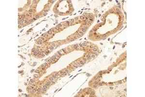 Immunohistochemistry analysis of paraffin-embedded human kidney using,RISC (ABIN7075546) at dilution of 1: 4000 (SCPEP1 抗体)