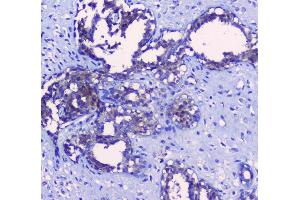IHC analysis of SRI using anti-SRI antibody (ABIN6719388). (SRI 抗体)