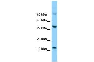 Western Blotting (WB) image for anti-Fatty Acid Binding Protein 5 (Psoriasis-Associated) (FABP5) (C-Term) antibody (ABIN2788321) (FABP5 抗体  (C-Term))