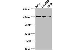 Western Blot Positive WB detected in: Hela whole cell lysate, Colo320 whole cell lysate, A549 whole cell lysate All lanes: ITGAV antibody at 2. (CD51 抗体  (AA 775-885))