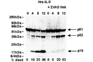 Western Blotting (WB) image for anti-Caspase 2, Apoptosis-Related Cysteine Peptidase (CASP2) antibody (ABIN187544) (Caspase 2 抗体)
