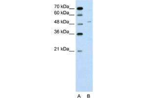 Western Blotting (WB) image for anti-Zinc Finger Protein 19 (ZNF19) antibody (ABIN2462568) (ZNF19 抗体)