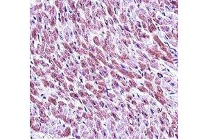 SMAD3 antibody immunohistochemistry analysis in formalin fixed and paraffin embedded human heart tissue. (SMAD3 抗体  (AA 127-156))