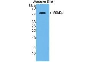 Detection of Recombinant IL28A, Human using Monoclonal Antibody to Interleukin 28A (IL28A) (IL28A 抗体  (AA 26-200))