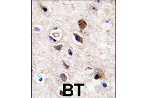 Formalin-fixed and paraffin-embedded human brain tissue reacted with PRKCG polyclonal antibody  , which was peroxidase-conjugated to the secondary antibody, followed by DAB staining . (PKC gamma 抗体  (C-Term))