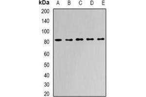 Western blot analysis of APEH expression in Jurkat (A), HepG2 (B), mouse liver (C), mouse kidney (D), rat bone marrow (E) whole cell lysates. (APEH 抗体)
