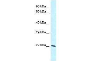 WB Suggested Anti-Laptm4b Antibody Titration: 1. (LAPTM4B 抗体  (C-Term))