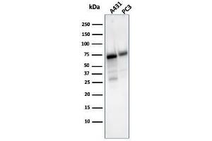 Western Blot Analysis of A431 and PC-3 cell lysate using CD73 Mouse Monoclonal Antibody (NT5E/2503).