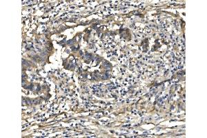 IHC analysis of PDE6 beta/PDE6B using anti-PDE6 beta/PDE6B antibody (ABIN7600894).