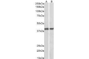 ABIN625823 (0. (GNAQ 抗体  (AA 162-175))