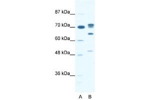 DDX21 antibody used at 0. (DDX21 抗体)