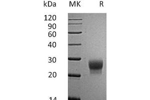 Western Blotting (WB) image for Colony Stimulating Factor 3 (Granulocyte) (CSF3) protein (His tag) (ABIN7320539) (G-CSF Protein (His tag))