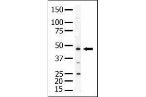 Antibody is used in Western blot to detect PIP5K2A in mouse skeletal muscle tissue lysate. (PIP4K2A 抗体  (N-Term))